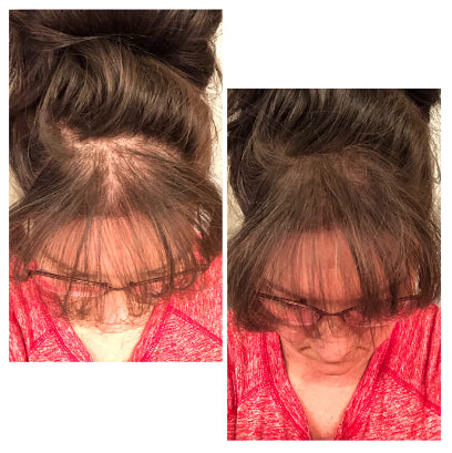 Bunee™ Corrector Capilar - cubre canas, poco pelo, alopecia y raices - 8 Tonos 🎁HOY 50%DCTO