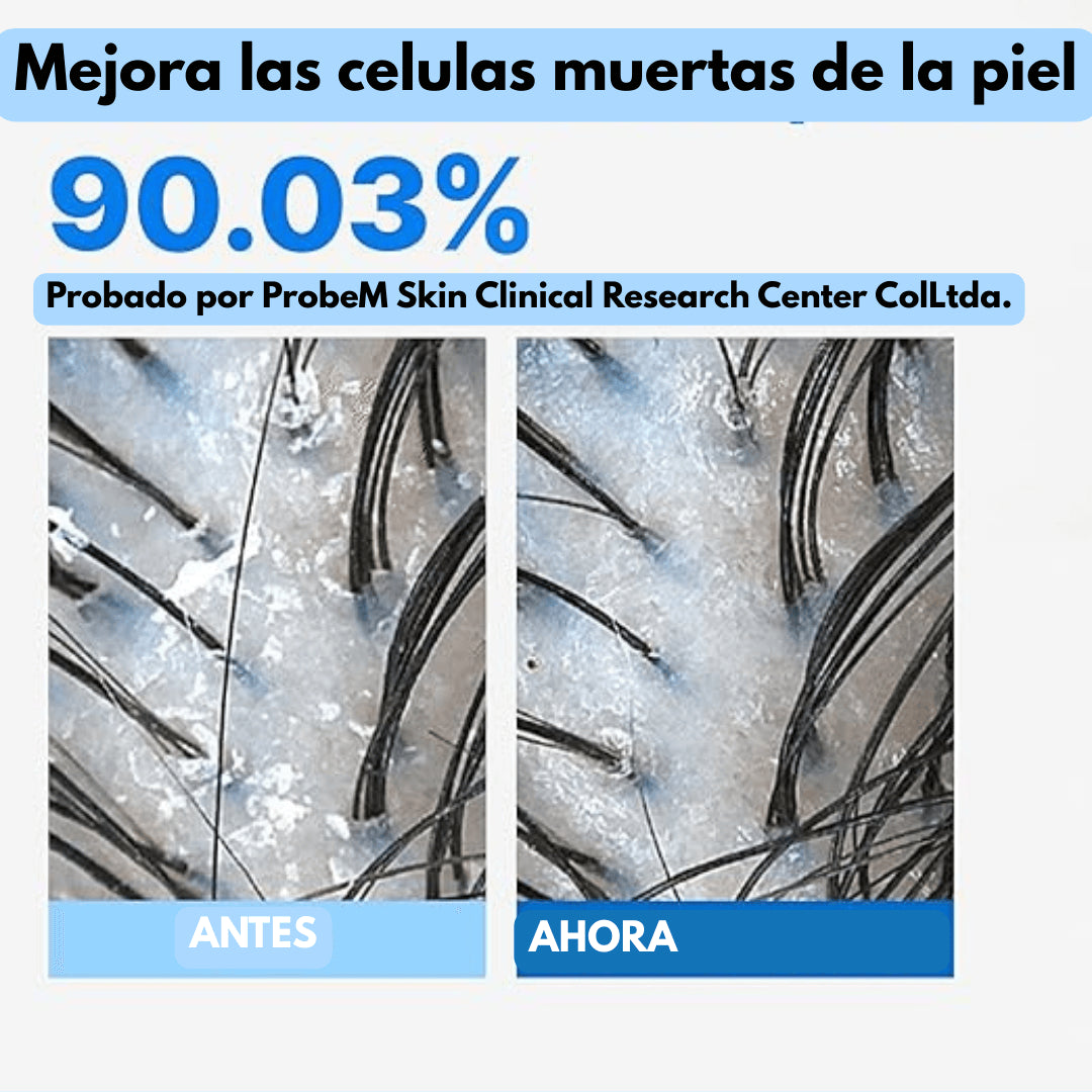 Hair Serum™ - Cuidado del cuero cabelludo para un cabello más fuerte, saludable y abundante