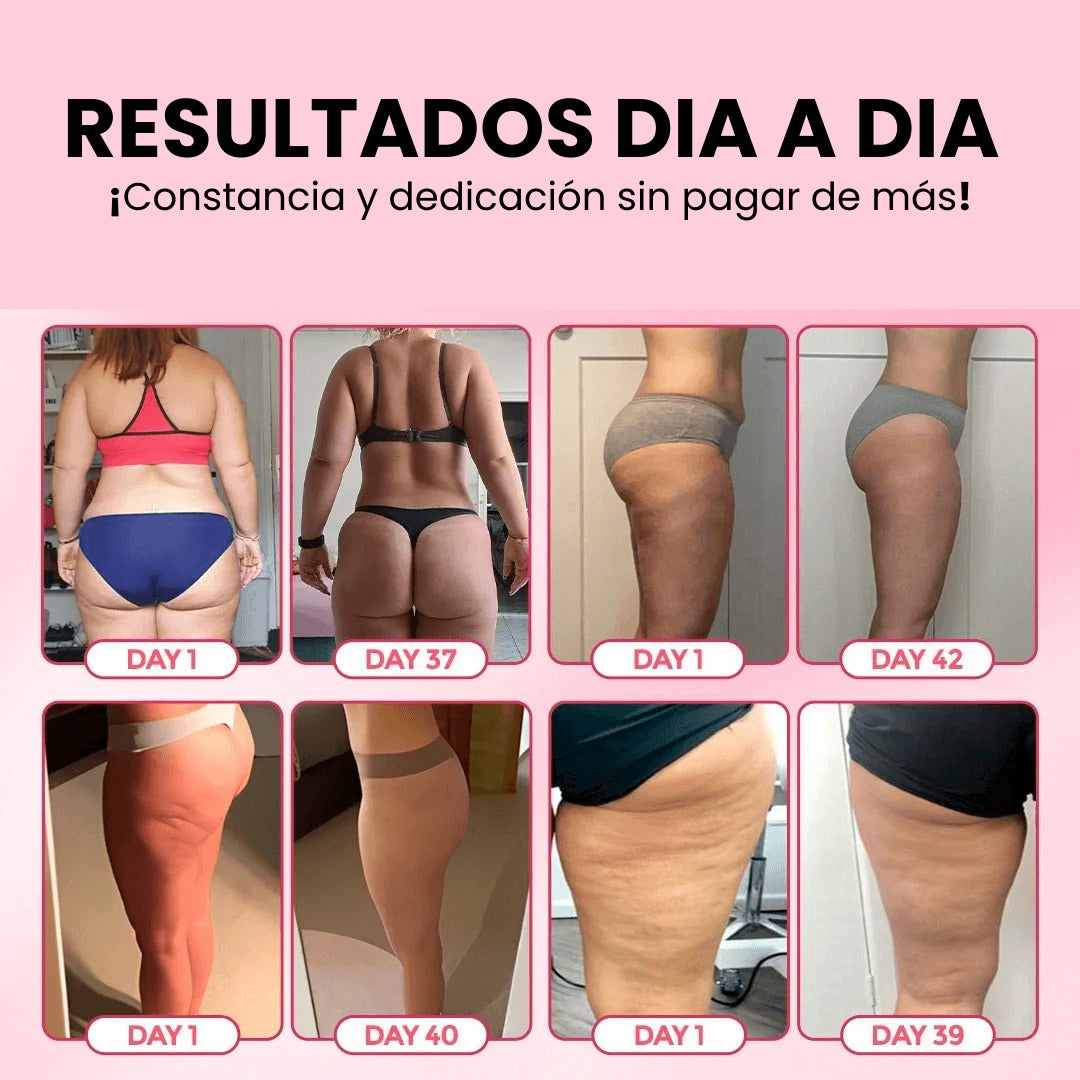 💜DERMAKILL™ ¡Adiós a la piel de naranja sin salir de casa!