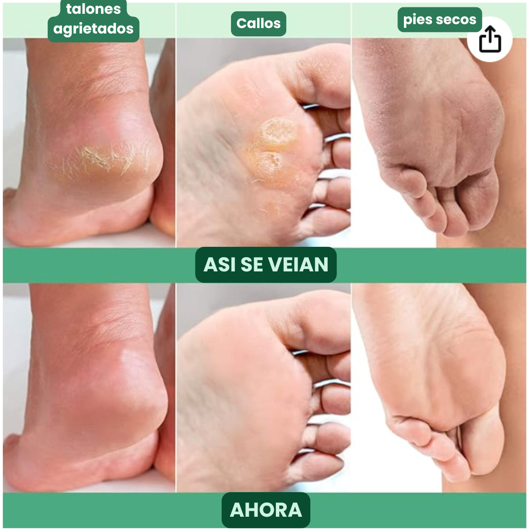 Foot Peel Mask™ Mascarilla Pies – Renueva la apariencia de tus pies desde casa🎁Lleva 6 unidades