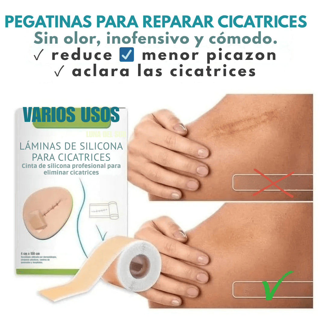 Cinta de silicona™ Multiproposito para la piel- ¡Uso cosmético en zonas con líneas visibles y cicatrices de la piel!
